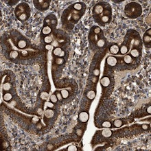 ab122093, at 1/200 dilution, staining C1orf168 in paraffin-embedded Human duodenum tissue by Immunohistochemistry.