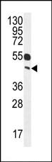 Anti-C1orf172 antibody (ab106993) at 1/100 dilution + Mouse liver tissue lysates at 35 µg