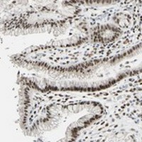 ab121278, at 1/50, staining C1orf174 in glandular cells of paraffin embedded Human stomach tissue by Immunohistochemistry.