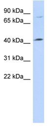 Anti-C1orf177 antibody (ab87303) at 1 µg/ml + 721_B cell lysate at 10 µgSecondaryanti-Rabbit IgG HRP at 1/50000 dilution