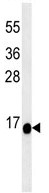 Anti-C1orf186 antibody (ab106987) at 1/100 dilution + Ramos cell line lysate at 35 µg