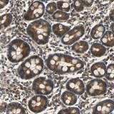 ab121220, at 1/250 dilution, staining C1orf198 in paraffin-embedded Human duodenum tissue by Immunohistochemistry.