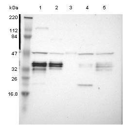 All lanes : Anti-C1orf198 antibody (ab121220) at 1/250 dilutionLane 1 : RT-4 cell lysateLane 2 : U-251 MG cell lysateLane 3 : Human PlasmaLane 4 : Human Liver tissue lysateLane 5 : Human Tonsil tissue lysatedeveloped using the ECL technique