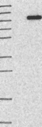 Lane 1: Marker [kDa] 250; 130; 95; 72; 55; 36; 28; 17; 10  Lane 2: Negative control (vector only transfected HEK293T lysate)  Lane 3: Over-expression Lysate (Co-expressed with a C-terminal myc-DDK tag (~3.1 kDa) in mammalian HEK293T cells. Lane 1: Marker [kDa] 250; 130; 95; 72; 55; 36; 28; 17; 10  Lane 2: Negative control (vector only transfected HEK293T lysate)  Lane 3: Over-expression Lysate (Co-expressed with a C-terminal myc-DDK tag (~3.1 kDa) in mammalian HEK293T cells.
