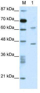 Anti-C1orf25 antibody (ab104817) at 1 µg/ml + Jurkat cell lysate at 10 µg