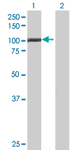 All lanes : Anti-C1orf25 antibody (ab67656) at 1/500 dilutionLane 1 : C1orf25 transfected 293T cell lysateLane 2 : Non transfected 293T cell lysateLysates/proteins at 25 µg per lane.SecondaryGoat Anti-Mouse IgG (H&L)-HRP Conjugate secondary antibody at 1/2500 dilution