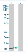 All lanes : Anti-C1orf38 antibody (ab67487) at 1/500 dilutionLane 1 : C1orf38 transfected 293T cell Lane 2 : non transfected 293T cell Lysates/proteins at 25 µg per lane.