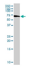 Anti-C1orf38 antibody (ab103169) at 1/500 dilution + K-562 cell lysates at 50 µg