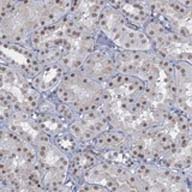 ab122736 at 1/200 dilution staining C1orf49 in Paraffin-embedded Human kidney tissue by Immunohistochemistry. 