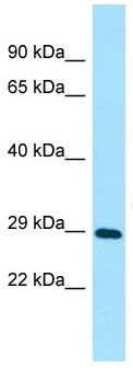 Anti-C1orf49 antibody - C-terminal (ab136689) at 1 µg/ml + Jurkat cell lysate at 10 µg