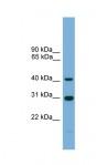 Anti-C1orf51 antibody (ab106120) at 1 µg/ml + Human fetal heart lysate at 10 µg