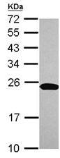 Anti-C1orf57 antibody (ab111867) at 1/1000 dilution + Jurkat whole cell lysate at 30 µg