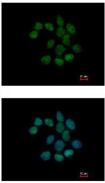 ab111867 at 1/200 dilution staining C1orf57 in methanol-fixed A431 cells by Immunofluorescence. The lower image is costained with Hoechst 33342.
