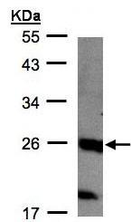 Anti-C1orf57 antibody (ab96287) at 1/1000 dilution + MOLT4 whole cell lysate at 30 µg