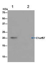 Western blot analysis of immunoprecipitation pellet from U87-MG cell lysate immunoprecipitated using ab182154 at 1/20 dilution.Secondary: Anti-Rabbit IgG (HRP), specific to the non-reduced form of IgG at 1/1500 dilution.