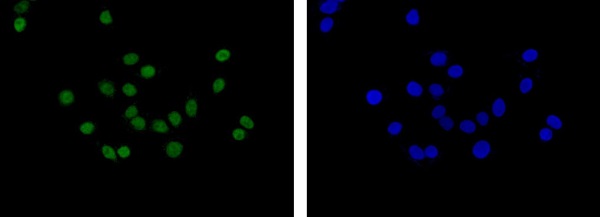 Immunofluorescence analysis of A549 cells, staining C1orf57 (green) with ab182155 at 1/100 dilution. An Alexa Fluor®488-conjugated goat anti rabbit IgG was used as a secondary antibody. Nuclei were counterstained with DAPI (blue).