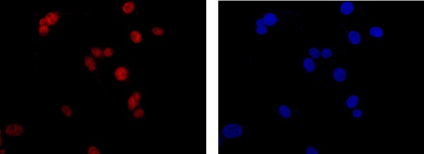 Immunofluorescence analysis of U87-MG cells, staining C1orf57 (red) with ab182155 at 1/100 dilution. An Alexa Fluor®555-conjugated goat anti rabbit IgG was used as a secondary antibody. Nuclei were counterstained with DAPI (blue).