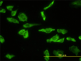 Acid Phosphatase 2 antibody (ab54721) used in immunofluorescence at 10ug/ml on HeLa cells.