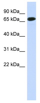 Anti-C1orf65 antibody (ab87192) at 1 µg/ml + human fetal muscle lysate at 10 µgSecondaryHRP-conjugated anti-Rabbit IgG at 1/50000 dilution