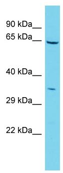 Anti-C1orf69 antibody - N-terminal (ab157789) at 1 µg/ml + 721_B cell lysate at 10 µg