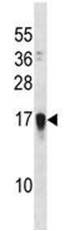 Anti-C1orf76 antibody (ab123546) at 1/100 dilution + CEM cell line lysates at 35 µg