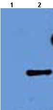All lanes : Anti-C1orf76 antibody (ab22139) at 1/1000 dilutionLane 1 : Total protein extract from E. coli with ~50ng to 100ng of a negative control fusion protein with an irrelevant antigen at 20 ugLane 2 : Total protein extract from E. coli with ~50ng to 500ng of the antigen fusion protein at 20 ugSecondaryRabbit anti-mouse IgG + IgM, (H+L) horseradish peroxidase conjugated at 1/5000 dilution