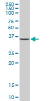 Anti-C1orf80 antibody (ab89465) at 1 µg/ml + human placenta tissue lysate at 50 µg