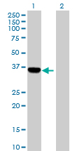 All lanes : Anti-C1orf80 antibody (ab89465) at 1 µg/mlLane 1 : C1orf80 transfected 293T cell lysateLane 2 : Non transfected lysateLysates/proteins at 25 µg per lane.