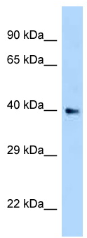 Anti-C1orf80 antibody (ab123018) at 1 µg/ml + 293T Cell lysate at 10 µgSecondaryGoat anti-Rabbit IgG HRP