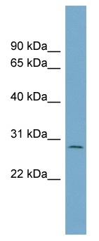 Anti-C1orf96 antibody (ab99126) at 1 µg/ml + ACHN Cell Lysate at 10 µg