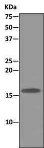 Western blot analysis on immunoprecipitation pellet from HeLa cell lysate using ab166896 at 1/10 dilution, and HRP-conjugated anti-rabbit IgG, preferentially detecting the non-reduced form of rabbit IgG.