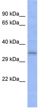 Anti-C20orf111 antibody (ab94723) at 1 µg/ml (in 5% skim milk / PBS buffer) + Human fetal heart lysate at 10 µgSecondaryHRP conjugated anti-Rabbit IgG at 1/50000 dilution
