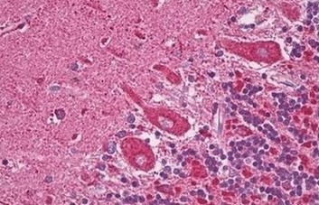 Immunohistochemical analysis of formalin fixed, paraffin embedded Human brain tissue (Cerebellum, Purkinje) labelling C20orf117 with ab140940 at 5 µg/ml.