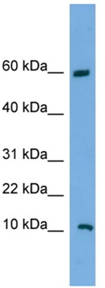 Anti-C20orf144 antibody (ab104330) at 1 µg/ml + NCI-H226 cell lysate at 10 µg