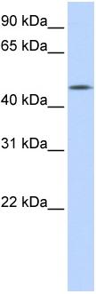 Anti-C20orf160 antibody (ab86615) at 1 µg/ml (5% skim milk/ PBS buffer) + transfected 293T cell lysate at 10 µg with gel concentration: 12%SecondaryHRP conjugated anti-Rabbit IgG at 1/50000 dilution