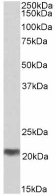 Anti-C20orf20 antibody (ab156811) at 0.3 µg/ml + Human Testis lysate (in RIPA buffer) at 35 µgdeveloped using the ECL technique