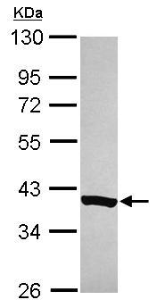 Anti-C20orf7 antibody (ab155208) at 1/2000 dilution + IMR32 whole cell lysate at 30 µg
