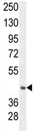 Anti-C20orf7 antibody (ab106984) at 1/100 dilution + Mouse heart tissue lysate at 35 µg