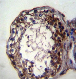 Immunohistochemical analysis of formalin-fixed, paraffin-embedded Human testis tissue labeling Acid sphingomyelinase with ab170579 at 1/10 dilution followed by peroxidase conjugation of the secondary antibody and DAB staining.