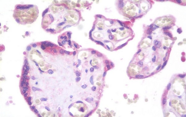 Immunohistochemical analysis of formalin-fixed, paraffin-embedded Human placenta tissue labeling C20orf70 with ab190088 at 10 µg/ml.