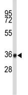 Anti-c20orf72 antibody (ab95093) at 1/100 dilution + CEM cell lysate at 35 µg