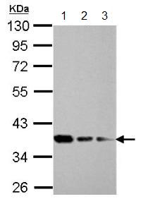 All lanes : Anti-C20orf77 antibody (ab154910) at 1/1000 dilutionLane 1 : 293T whole cell lysateLane 2 : HeLa whole cell lysateLane 3 : HepG2 whole cell lysateLysates/proteins at 30 µg per lane.