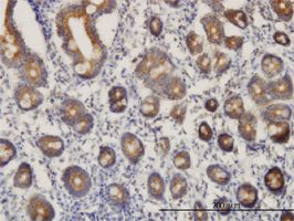 C21orf33 antibody (ab56459) used in immunohistochemistry at 3ug/ml on formalin fixed and paraffin embedded human small Intestine.