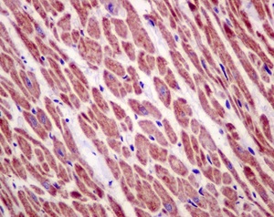 Immunohistochemical analysis of paraffin-embedded Human heart tissue labeling C21orf33 using ab181366 at a 1/50 dilution.