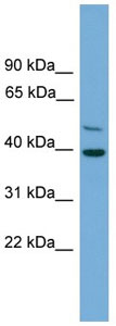 Anti-C21orf58 antibody (ab105785) at 1 µg/ml + Jurkat cell lysate at 10 µg