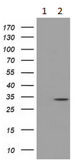 All lanes : Anti-C21orf59 antibody [1A1] (ab117944) at 1/2000 dilutionLane 1 : HEK293T cells were transfected with the pCMV6-ENTRY control cDNA for 48 hrs and lysed. Lane 2 : HEK293T cells were transfected with the pCMV6-ENTRY C21orf59 cDNA for 48 hrs and lysed.Lysates/proteins at 5 µg per lane.