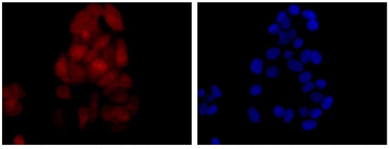 Immunofluorescent analysis of MCF7 cells (paraformaldehyde-fixed, 4%), labeling C21orf59 with ab181173 at 1/100 dilution followed by Goat anti rabbit IgG (Alexa Fluor® 488) secondary at 1/200 dilution and counter-stained with DAPI (blue).