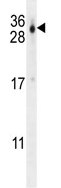 Anti-C21orf70 antibody (ab107591) at 1/100 dilution + Mouse stomach tissue lysate at 35 µg