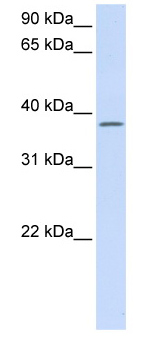 Anti-C21orf91 antibody (ab80695) at 1 µg/ml + fetal lung lysate at 10 µgSecondaryHRP conjugated anti-Rabbit IgG