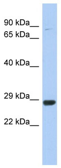 Anti-C21orf91 antibody (ab90145) at 1 µg/ml (in 5% skim milk / PBS buffer) + THP1 cell lysate at 10 µgSecondaryHRP conjugated anti-Rabbit IgG at 1/50000 dilution
